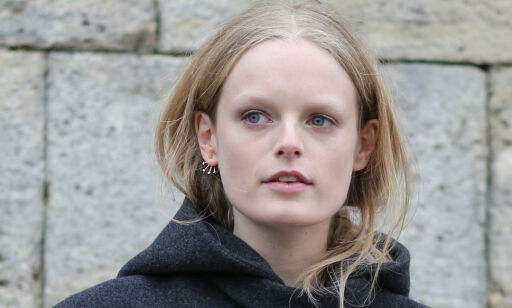 Hanne (28) ble utsatt for operasjoner som ikke var medisinsk nødvendig: - Det ble et traume på grunn av det de gjorde