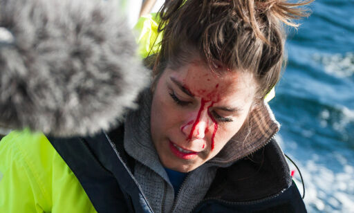Bloggeren havnet i blodig drama under tv-innspilling: - Fikk sjokk