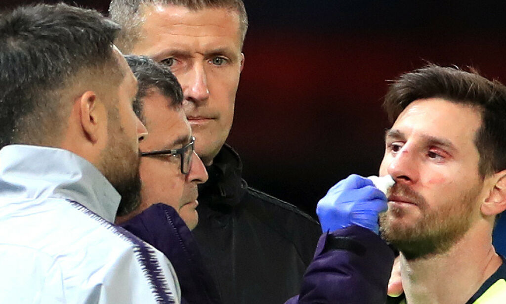 Messi albuet til blods